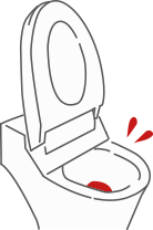 血便がでている